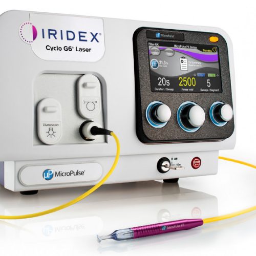 Laser za retinu, Iridex