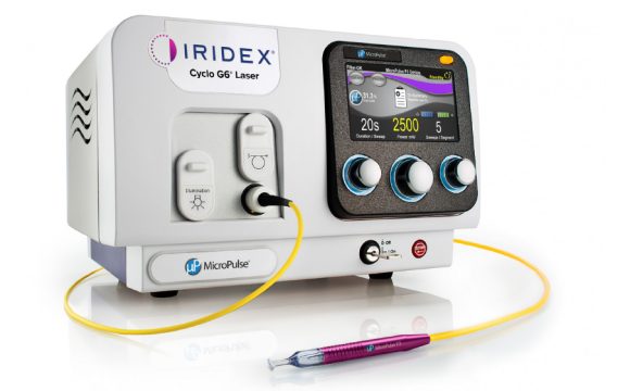 Laser za retinu, Iridex