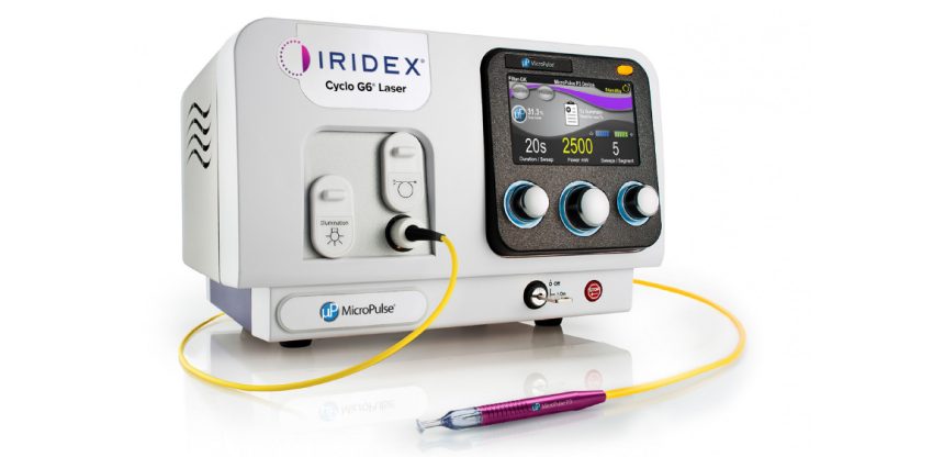 Laser za retinu, Iridex