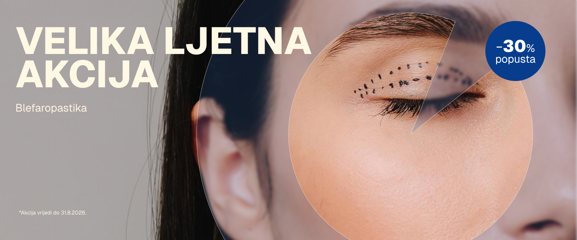 Velika ljetna akcija poliklinika RITZ